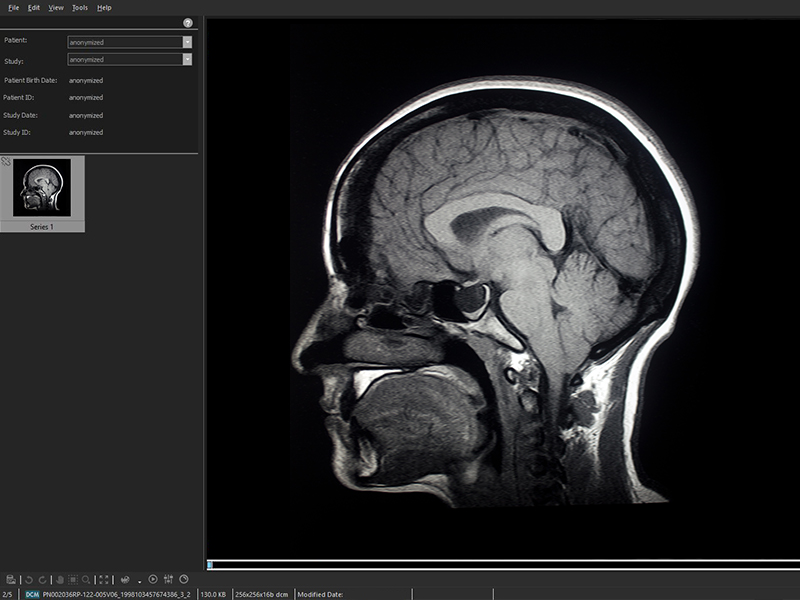 SeePlus DICOM - a professional DICOM viewer